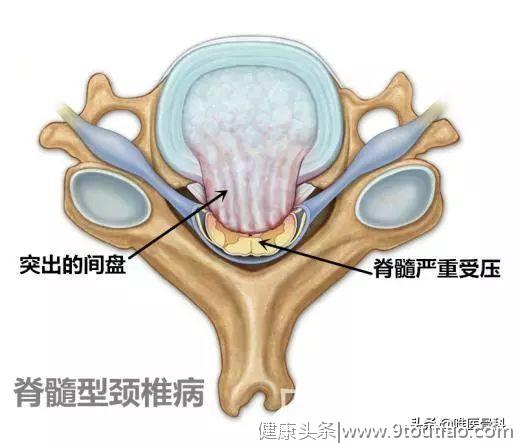 颈椎病里的五花三层—颈椎的结构和功能