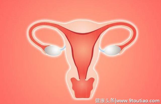 子宫肌瘤：身体3个异常症状敲警钟