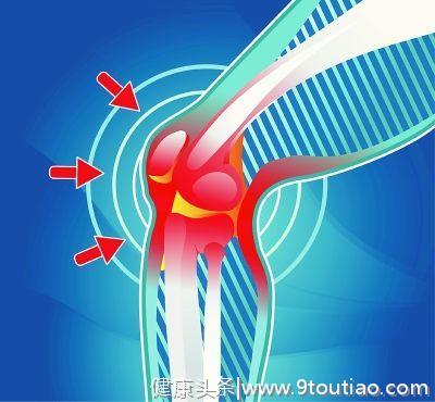 中国有多少人患风湿病？如何鉴别痛风、风湿和类风湿关节炎？