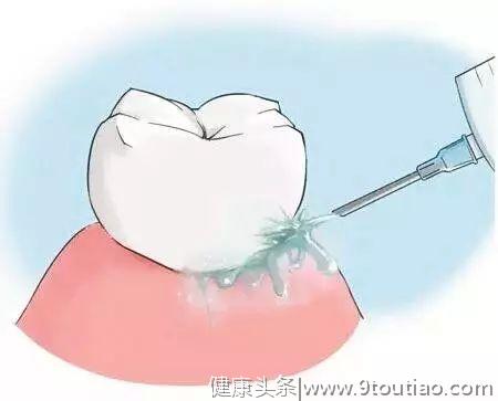 营养师丨牙齿每天都用，每天都刷，你真的会护牙吗？