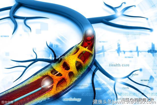 药物、支架、搭桥手术，糖尿病冠心病患者该治疗如何选择治疗方式