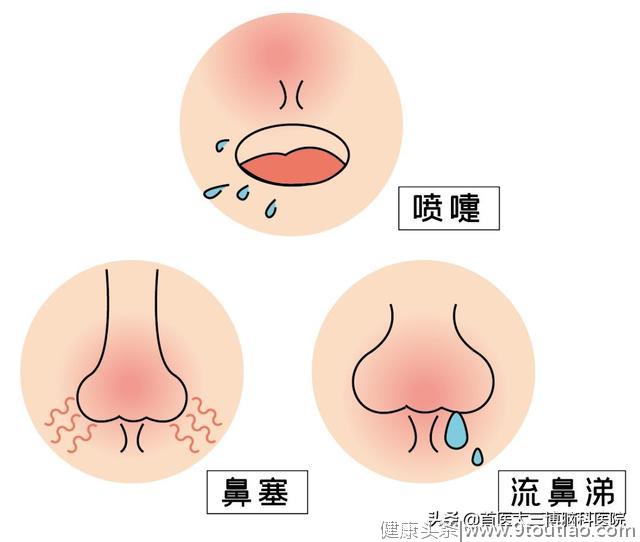 会呼吸的痛！又到鼻炎高发季，预防鼻炎应该怎么做？