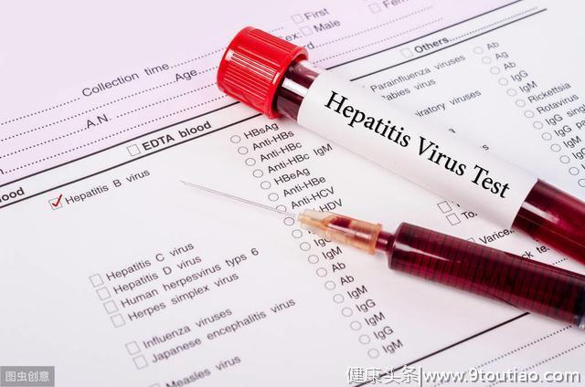 病毒性肝炎有3种，其中1种早发现能治愈，快对照下你是不是