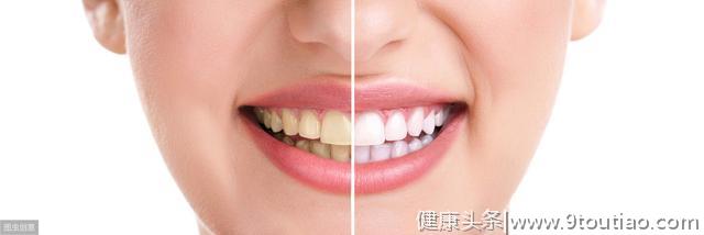 牙齿上面有黄色的物质还有异味？牙医教你2个办法，保护牙齿健康
