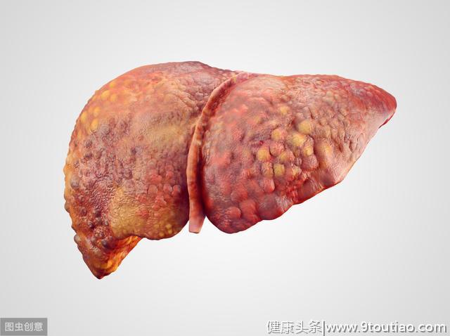 为何“肝癌”越来越多？生活中，这3件事对肝脏伤害不小，莫忽视