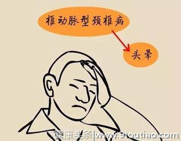 什么是颈椎病？具体情况是哪些？