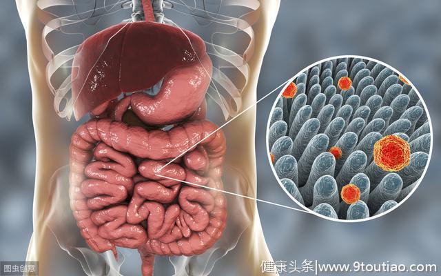怎样增强癌症治疗功效？改善肠道细菌可能有效