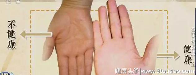手是健康的镜子，10种常见病，从手上就能看出来