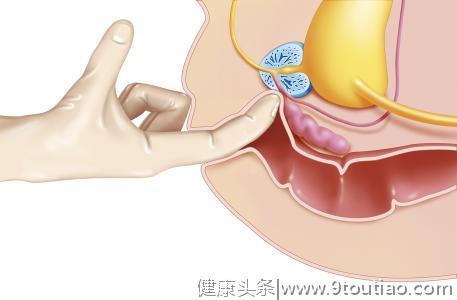 泌尿外科医生：经常尿血、尿痛、骨痛？当心是前列腺癌