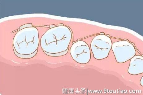 辟谣｜牙齿矫正，会伤害牙神经？