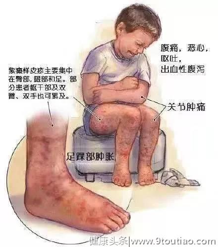 孩子总是喊腿疼，未必是“长个儿”！可能是这种“皮肤病”作祟