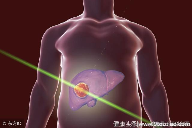 身体亮起这6个“红灯”，提示你肝癌正在慢慢靠近！别忽视！