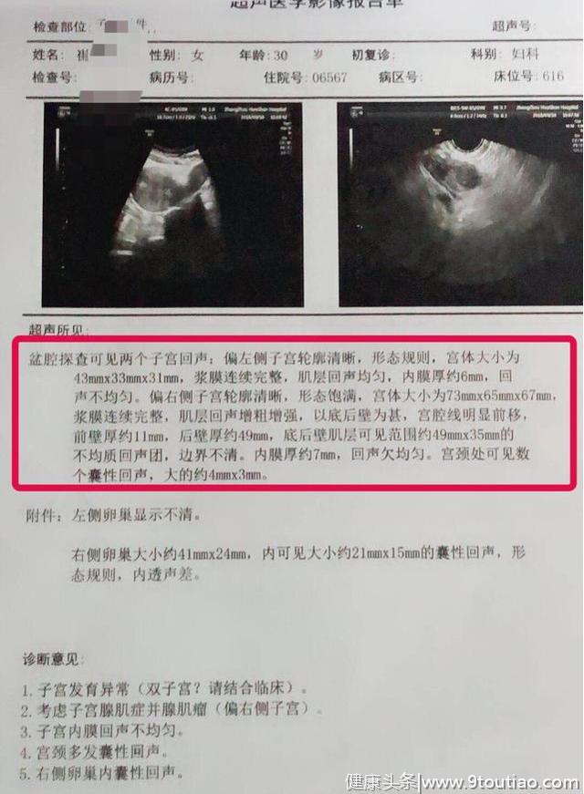 「罕见」双子宫腺肌症患者，痛经要承受双倍吗？