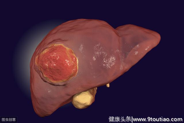 身体出现2个症状，可能是肝癌信号，做好3件事，肝脏1天比1天健康