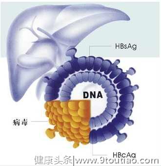 什么是乙肝？乙肝会传染吗？需要注意哪些问题？