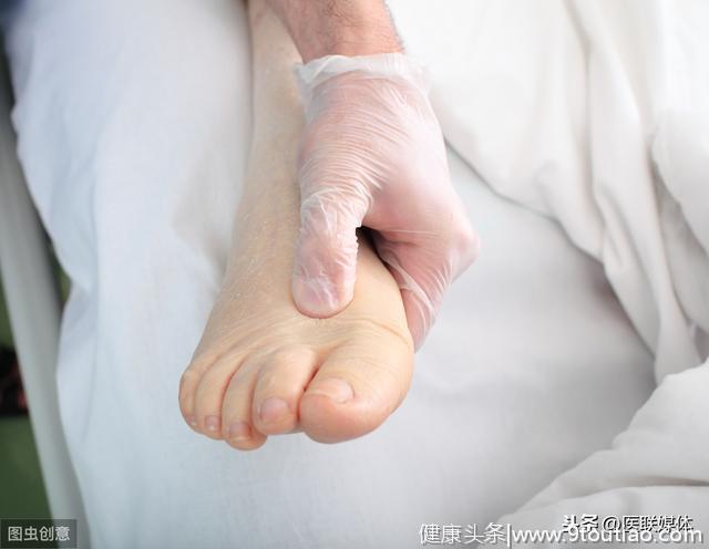 早期癌症不明显，但手脚若出现这5个异变，就值得注意了