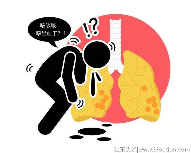 肺癌大多数是“拖”出来？一旦有这4种异常，劝你及时做个检查