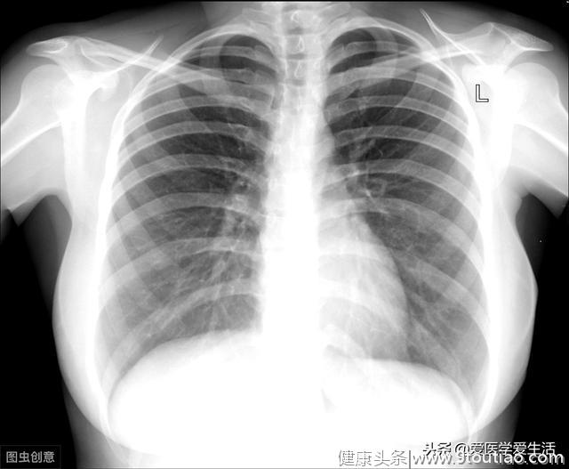 医学知识科普：肝癌（中篇）的超声、CT、MRI诊断方法以及分期