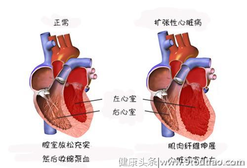 心脏病有多可怕？它对身体有什么影响？