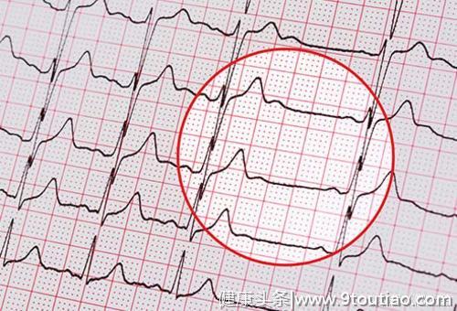 心脏病有多可怕？它对身体有什么影响？