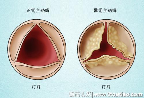 心脏病有多可怕？它对身体有什么影响？