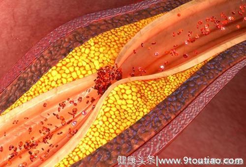 心脏病有多可怕？它对身体有什么影响？