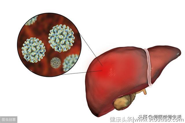 医学知识科普：肝癌（上篇）的发病率、发病原因、临床表现