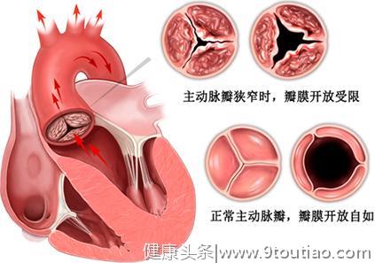 心脏难受就觉得有心脏病，到底心脏病指什么？和冠心病是一回事吗