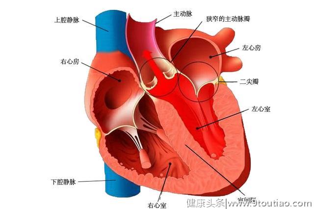 心脏难受就觉得有心脏病，到底心脏病指什么？和冠心病是一回事吗