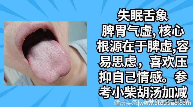 舌诊哥：口腔溃疡、疲劳乏力、情绪低落等舌象分析