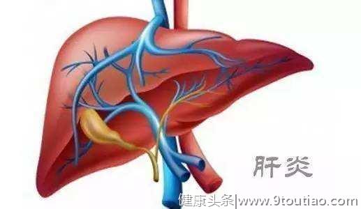 肝炎病情加重 可通过6种皮肤症状察觉！
