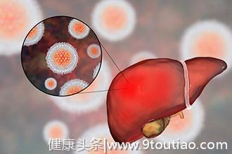 纹身可能导致丙肝？丙肝问题你了解么