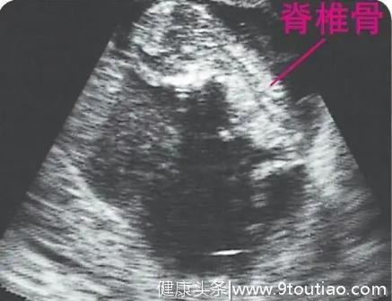 怀孕1-9个月，准妈妈通过B超看胎儿慢慢长大的样子，真是很神奇