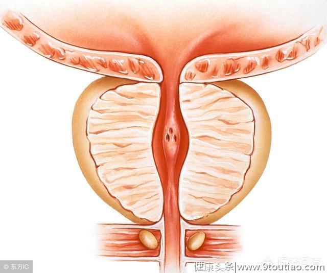 前列腺怎么保养？