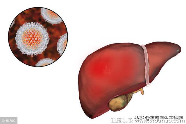 感染上肝炎会有什么表现？不少病人回忆：多数有这一感觉