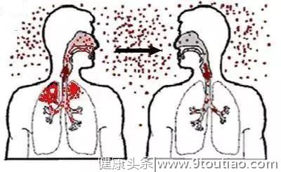 武汉新型肺炎 | 冠状病毒在空气中能活多久？这三点建议快收好