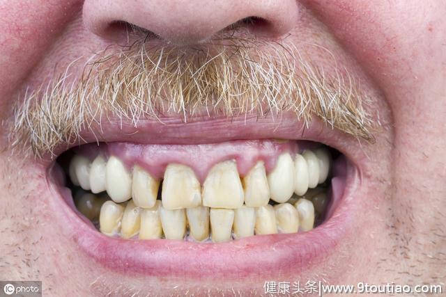 牙齿出现3种现象，若不及时处理，一个烧钱的无底洞在等着你