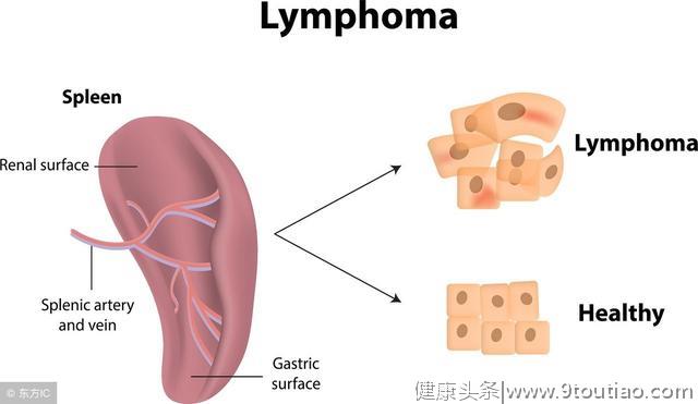 如何才能预防癌症？医生透露：这3个要点是防癌根本