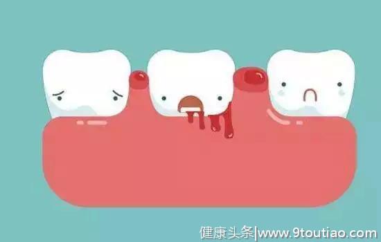 关于牙齿，你应该知道这些