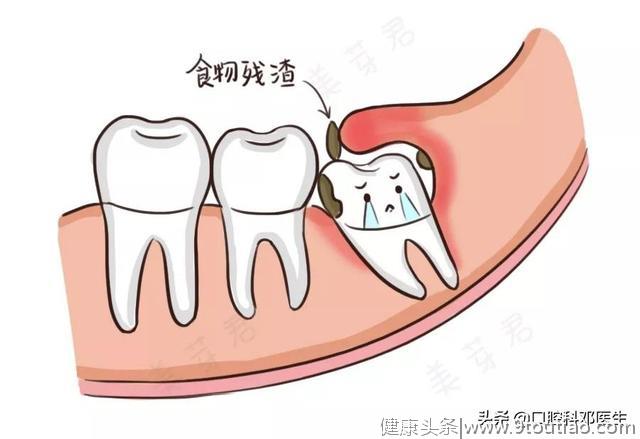 新型肺炎疫情下，医生教你如何在家处理7类牙齿问题？