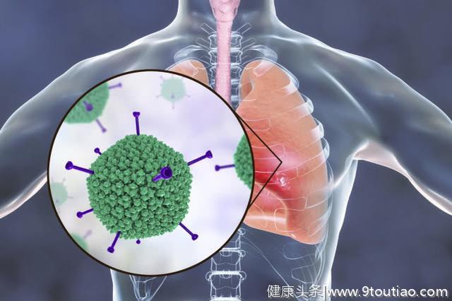 说到肺炎，这8个重要的医学常识，每个人都应该知道