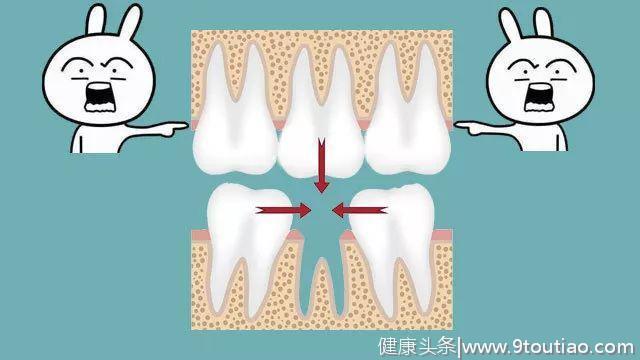 几百元可以搞定，为何却花费上万？牙齿若出现这个，注定是烧钱