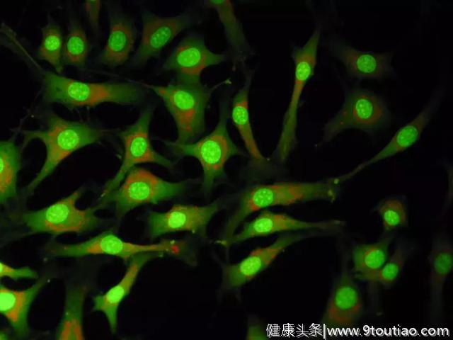 癌症研究实验结果不一致，因为科学家都用错了培养基