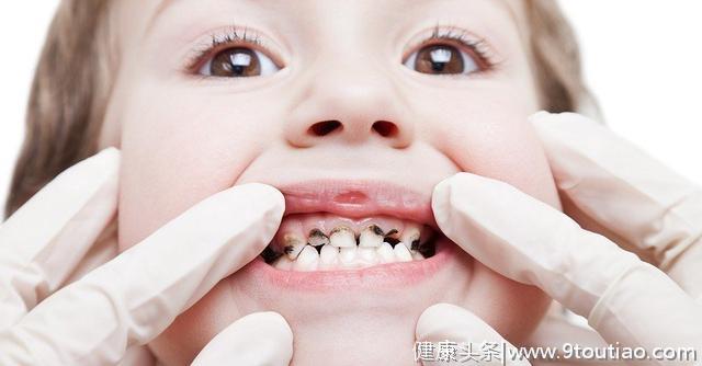 三岁前的口腔健康 影响孩子一生，8招让孩子接受刷牙