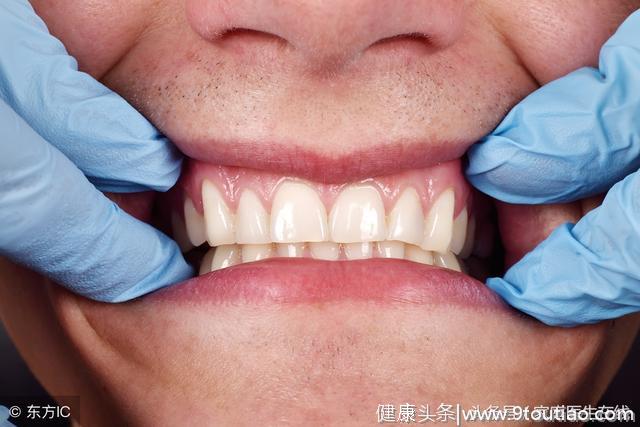 出现这6种症状，不能忽视！说明你的牙齿正在逐渐衰老