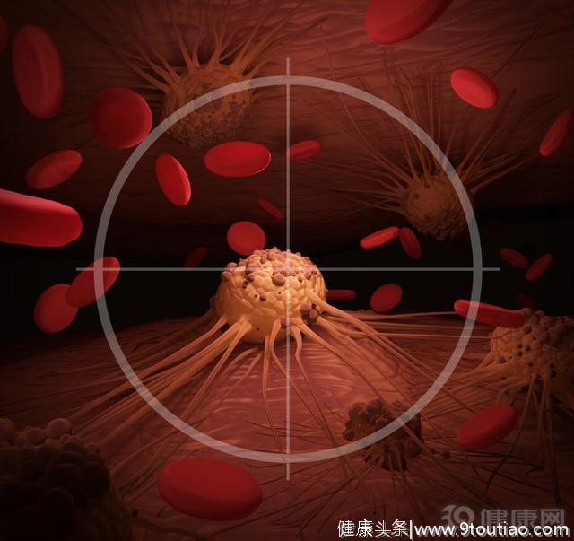 癌症有这两种特征：动手术，可以活下来！别再拒绝了