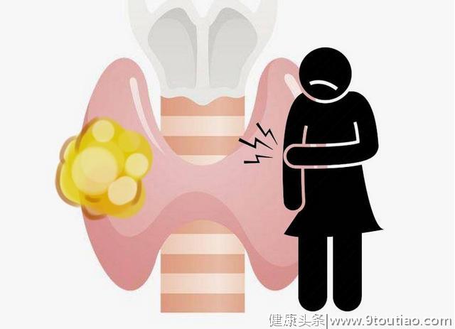 这4种癌症或有遗传风险，家中若有人得了，需提高警惕，加强筛查