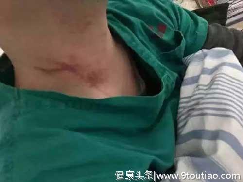 武汉肺炎病人家属殴打医生，疑似感染病毒，已被取保候审