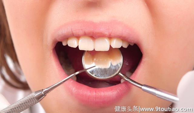 口腔健康很重要，牙龈疾病会增加脑血管风险好几倍