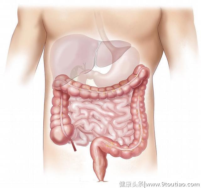 放屁多，容易得肠癌吗？排查肠癌，3个方法来得更靠谱